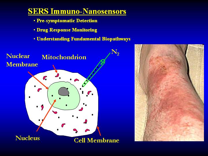 Intracellular SERS Nanosensors